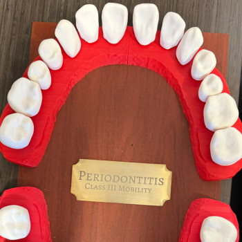 Diş Anatomisi 3D Baskı Tıklamalı Diş Seti - Eğitim Modeli