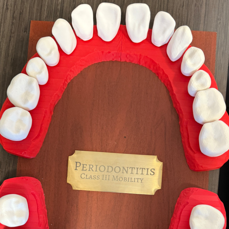 Diş Anatomisi 3D Baskı Tıklamalı Diş Seti - Eğitim Modeli