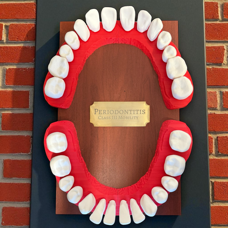 Diş Anatomisi 3D Baskı Tıklamalı Diş Seti - Eğitim Modeli