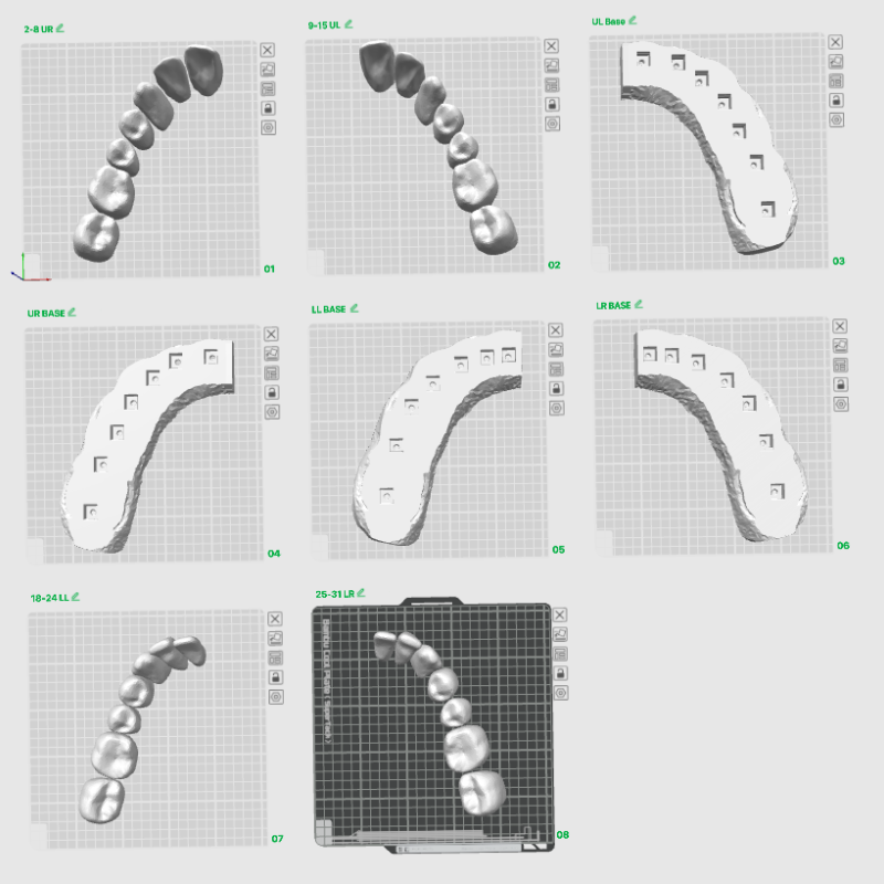 Diş Anatomisi 3D Baskı Tıklamalı Diş Seti - Eğitim Modeli