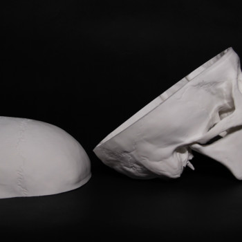 Anatomik Doğru Öğrenci Kafatası Modeli - 3D Baskı Eğitim