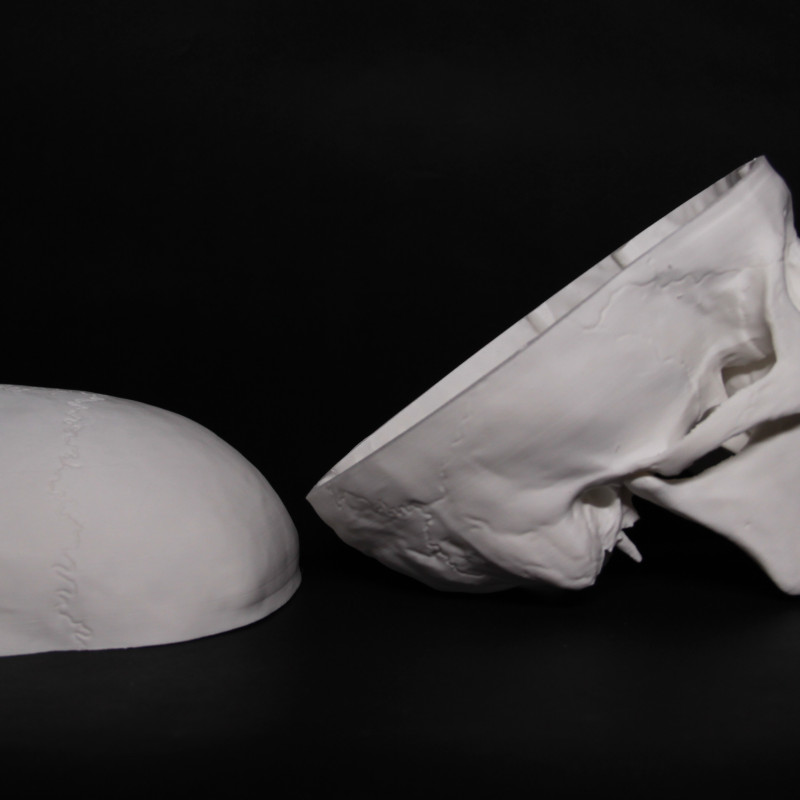 Anatomik Doğru Öğrenci Kafatası Modeli - 3D Baskı Eğitim