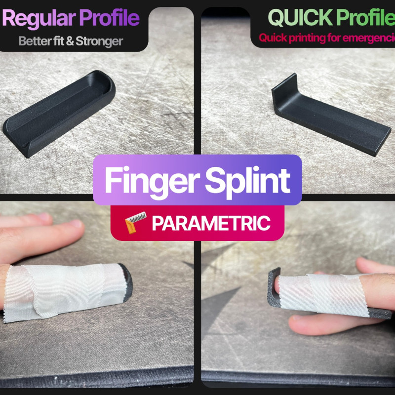 Parametrik Parmak Ateli - Kişiye Özel 3D Baskı Tıbbi Destek